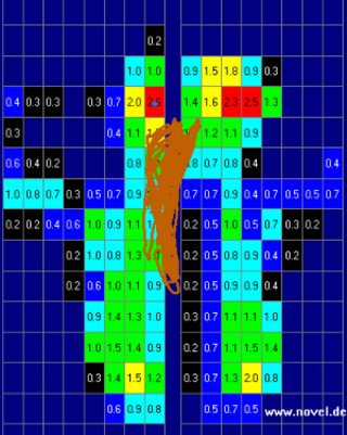 Assiette dorsolombaire, on peut aisément se rendre compte que l'impact sur le cheval ne peut être que négatif.